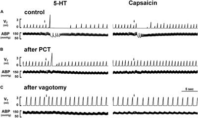 Stimulatory Effect of 5-Hydroxytryptamine (5-HT) on Rat Capsaicin-Sensitive Lung Vagal Sensory Neurons via Activation of 5-HT3 Receptors